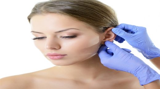 علاج الأذن البارزة طبيعيا