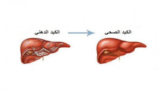 ما هو الكبد الدهني