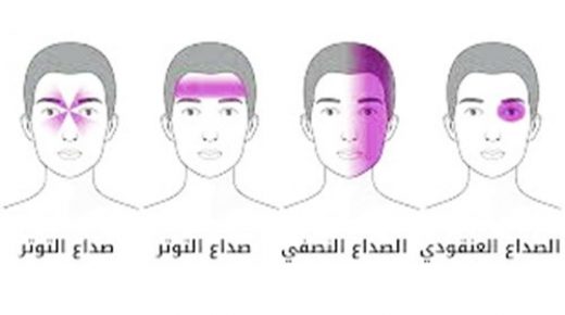 ما هي أنواع الصداع؟