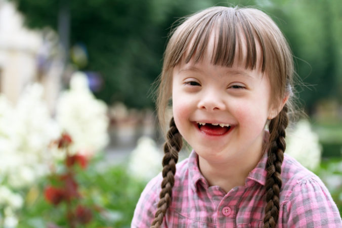 Down Syndrome girl 676x451 1 - موقع رموش