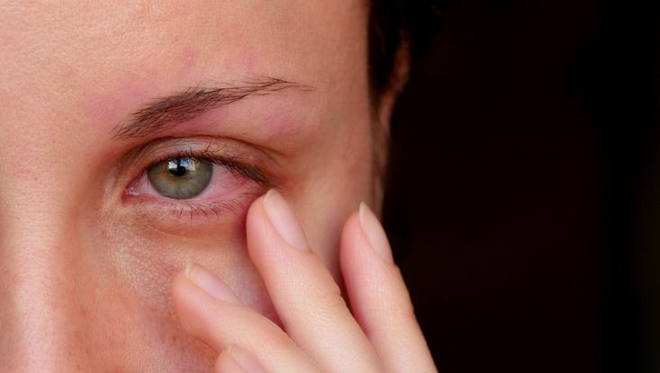 أعراض التهاب العين