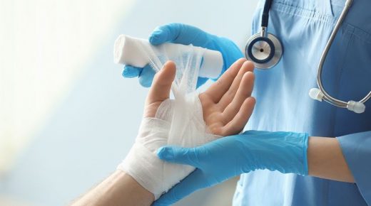 علاج الحروق