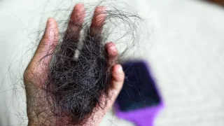 أسباب تساقط الشعر
