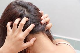 القمل في المنام لابن سيرين