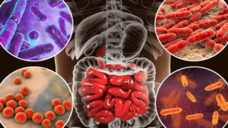 الالتهابات البكتيرية