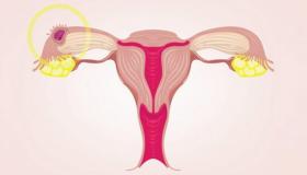 ما هي علامة التبقيع أثناء الحمل وما هو العلاج المناسب؟