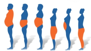 هل الاجهاد يسبب السمنة