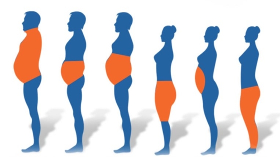 هل الاجهاد يسبب السمنة