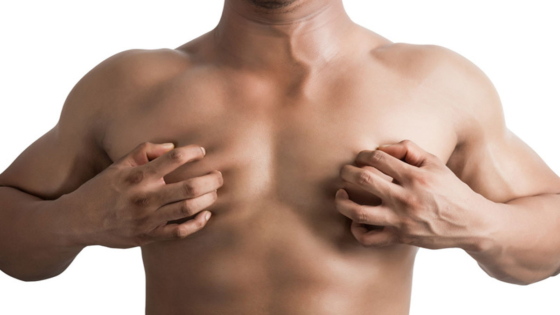 علاج التثدي عند الرجال