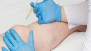 الأكلات التي تعوض السائل في الركبة