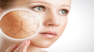 البشرة الجافة