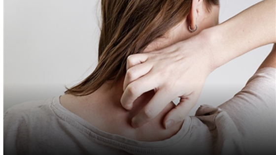 حكة الجلد أثناء الحمل