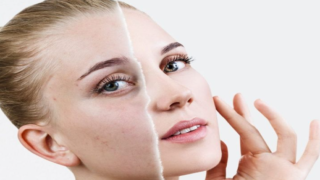 شيخوخة الجلد