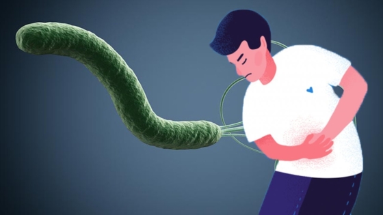 علاج جرثومة المعدة بالأعشاب مجرب