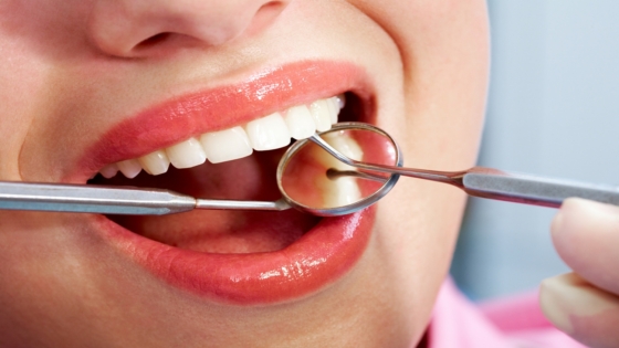 تفسير رؤية تساقط الأسنان في المنام