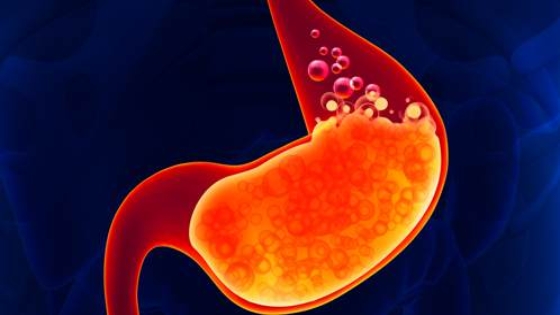 أفضل علاج حرقة المعدة