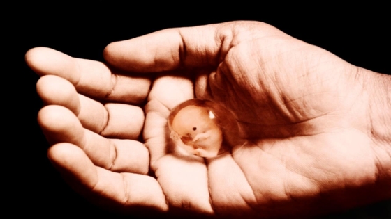 الإجهاض في المنام