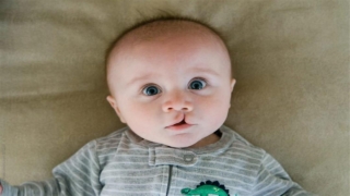 عملية الشفة الارنبية