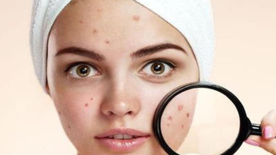 أفضل عيادة للبشرة