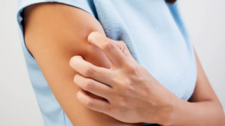 حكة في الجسم