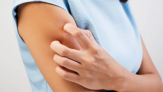 حكة في الجسم