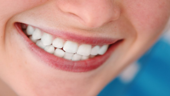 العلاجات المنزلية لتبييض الأسنان