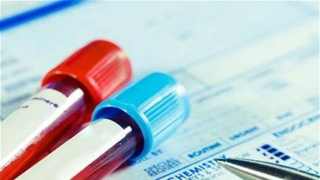 الاختبارات الأساسية للنساء