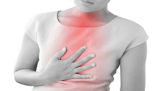 ارتجاع المريء