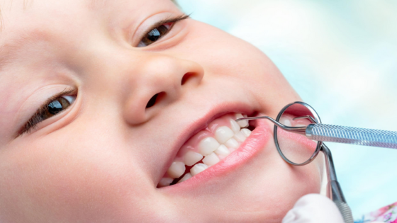 الأسنان اللبنية