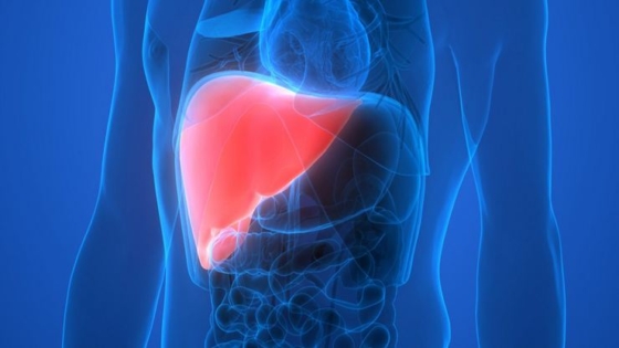 الكبد الدهني