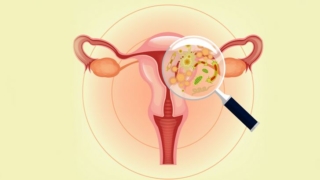 التهاب المهبل الجرثومي