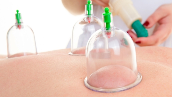 ما هي الحجامة وما فوائدها