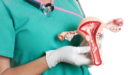 استئصال الرحم