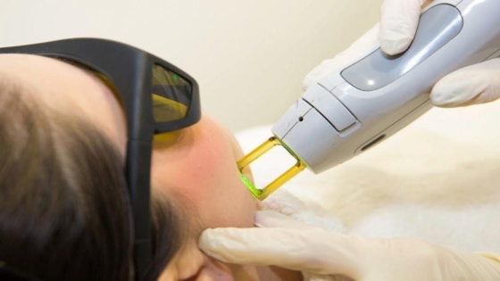 الليزر يسبب تشوهات للجنين