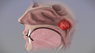 الزائدة الأنفية