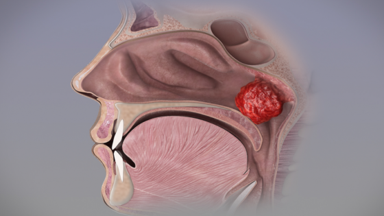 الزائدة الأنفية