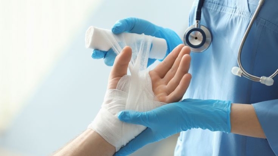 علاج الحروق