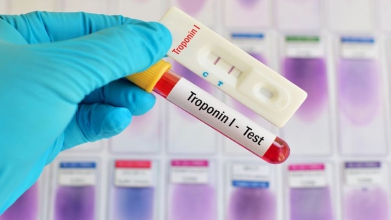 أمراض القلب