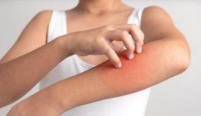 أي نوع من المرض هو التهاب الجلد؟