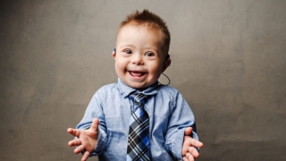 متلازمة داون