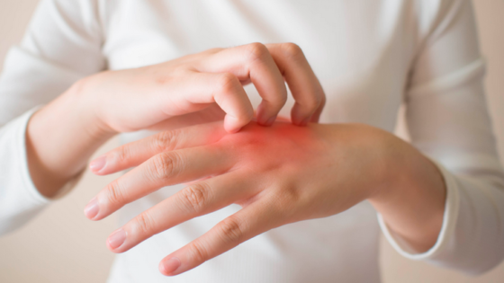 الكبد الدهني