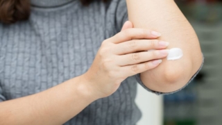 منع جفاف الجلد