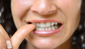 العادات الخاطئة في الصحة واصفرار الاسنان