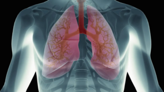 انخماص الرئة