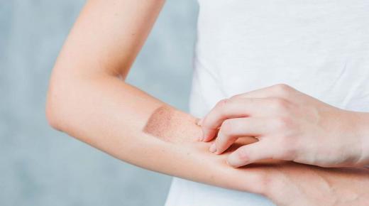 ما هو التهاب الجلد وتعرف على أسبابه