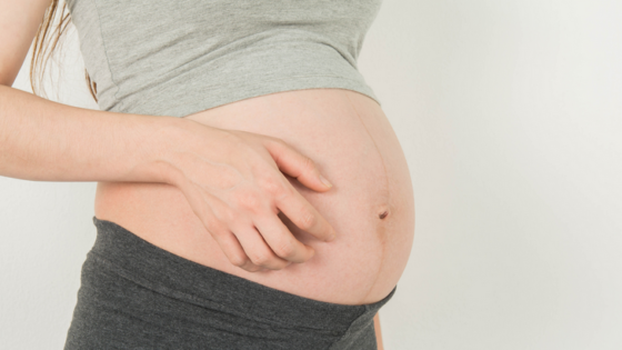 الركود الصفراوي