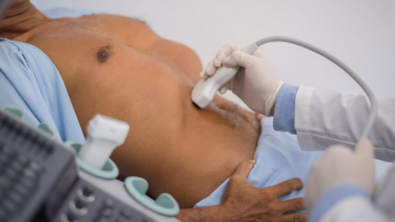 تشخيص الكبد الدهني