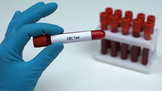 اختبار CBC