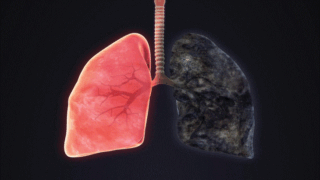 انتفاخ الرئة