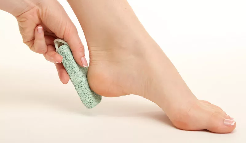 تشقق القدمين